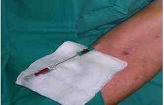 insercion-picc