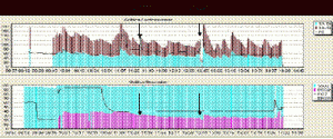 grafica-intraoperatoria-constantes-hemodinamicas-respiratorias