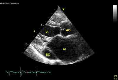 Eco para diagnostic