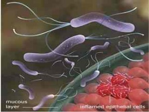 Helicobacter-pylori-bacteria