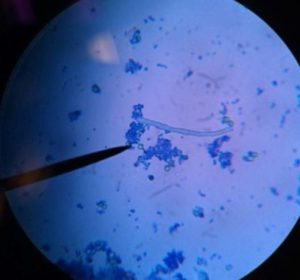 conidios-del-hongo-filamentoso-Aspergillus-fumigatus