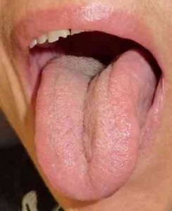 lengua-saburral