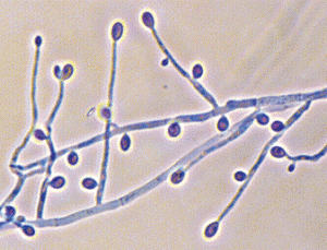 microscopio-Scedosporium-apiospermun