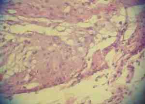 corazon-dosis-maxima-plomo