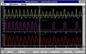 monitorizacion-ventilacion-mecanica