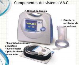 VAC-terapia-presion-negativa