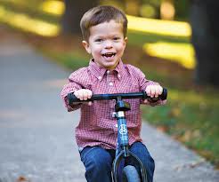 acondroplasia